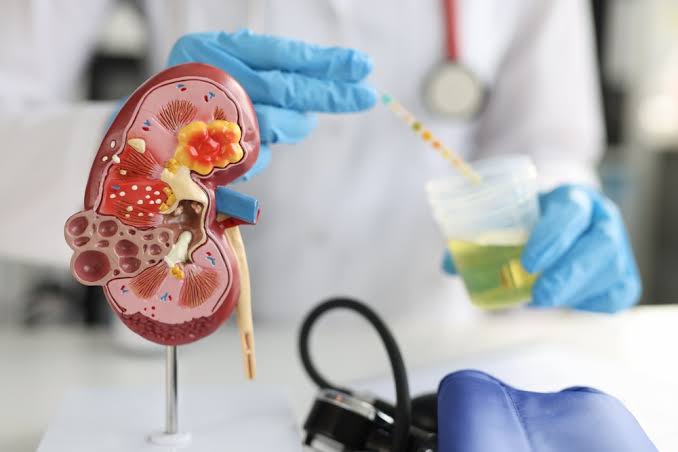 Kidney Function Test